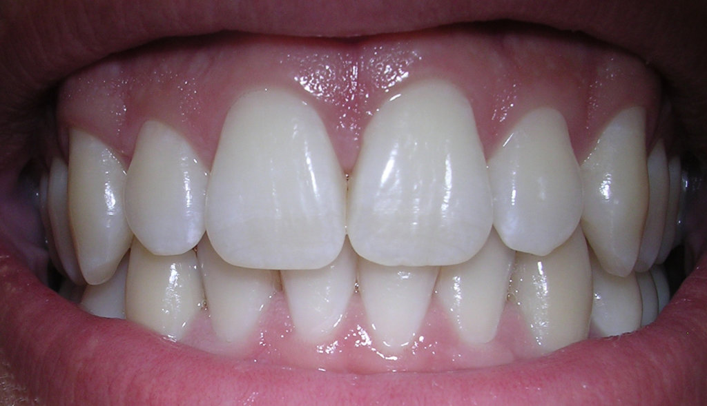 Photo of Gums